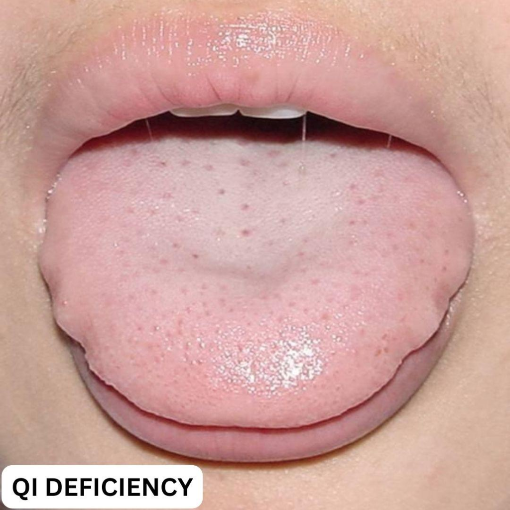 Your Tongue Shows Your Health