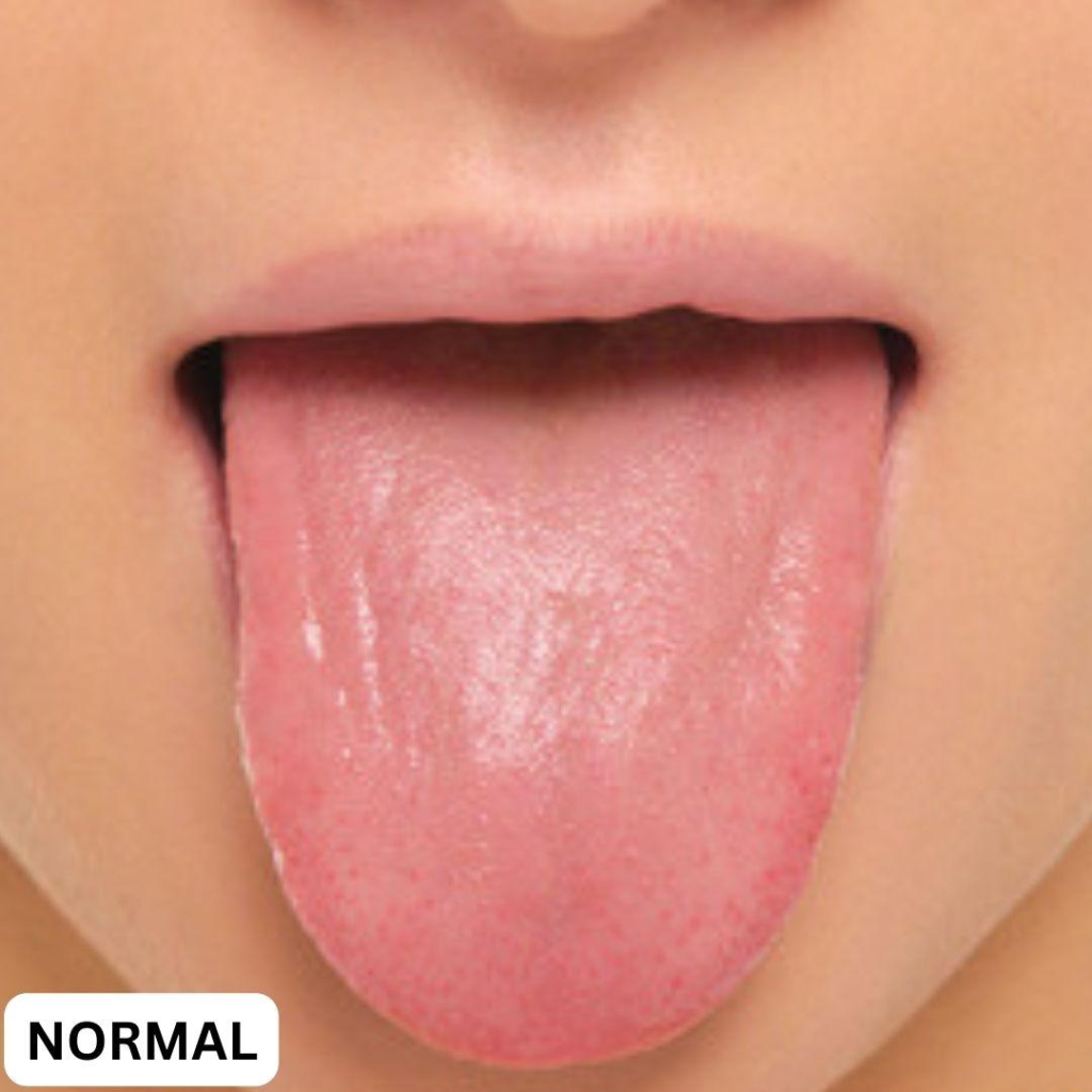 Your Tongue Shows Your Health