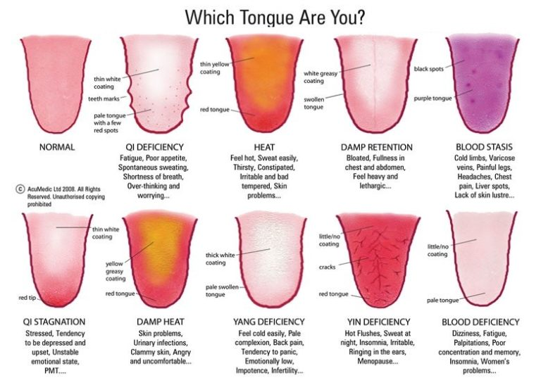 Your Tongue Shows Your Health