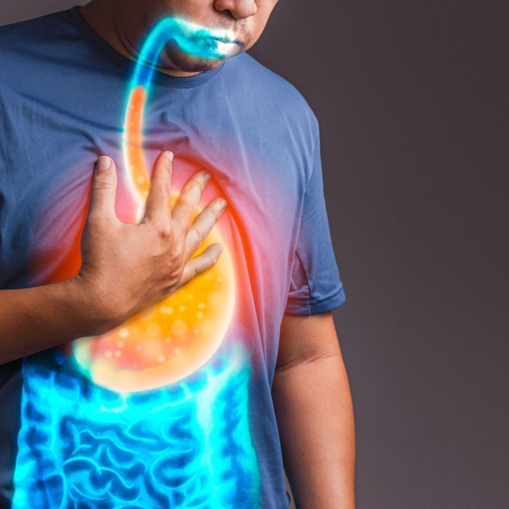 Acid Reflux in Functional Medicine