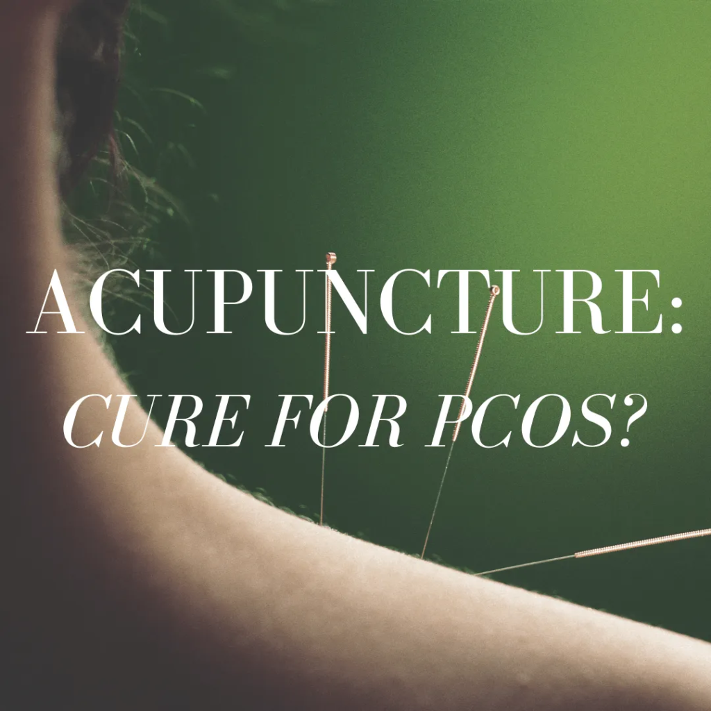 Yes! Acupuncture is proven to help with anxiety, depression, and weight gain caused by PCOS!