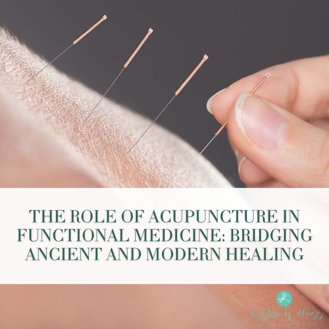 The Role of Acupuncture in Functional Medicine: Bridging Ancient and Modern Healing